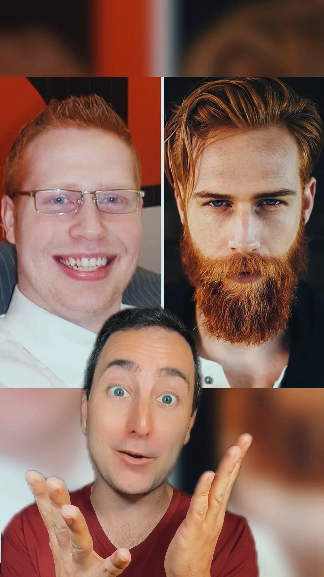 Before and After: Growing a Beard #shorts – YouTube