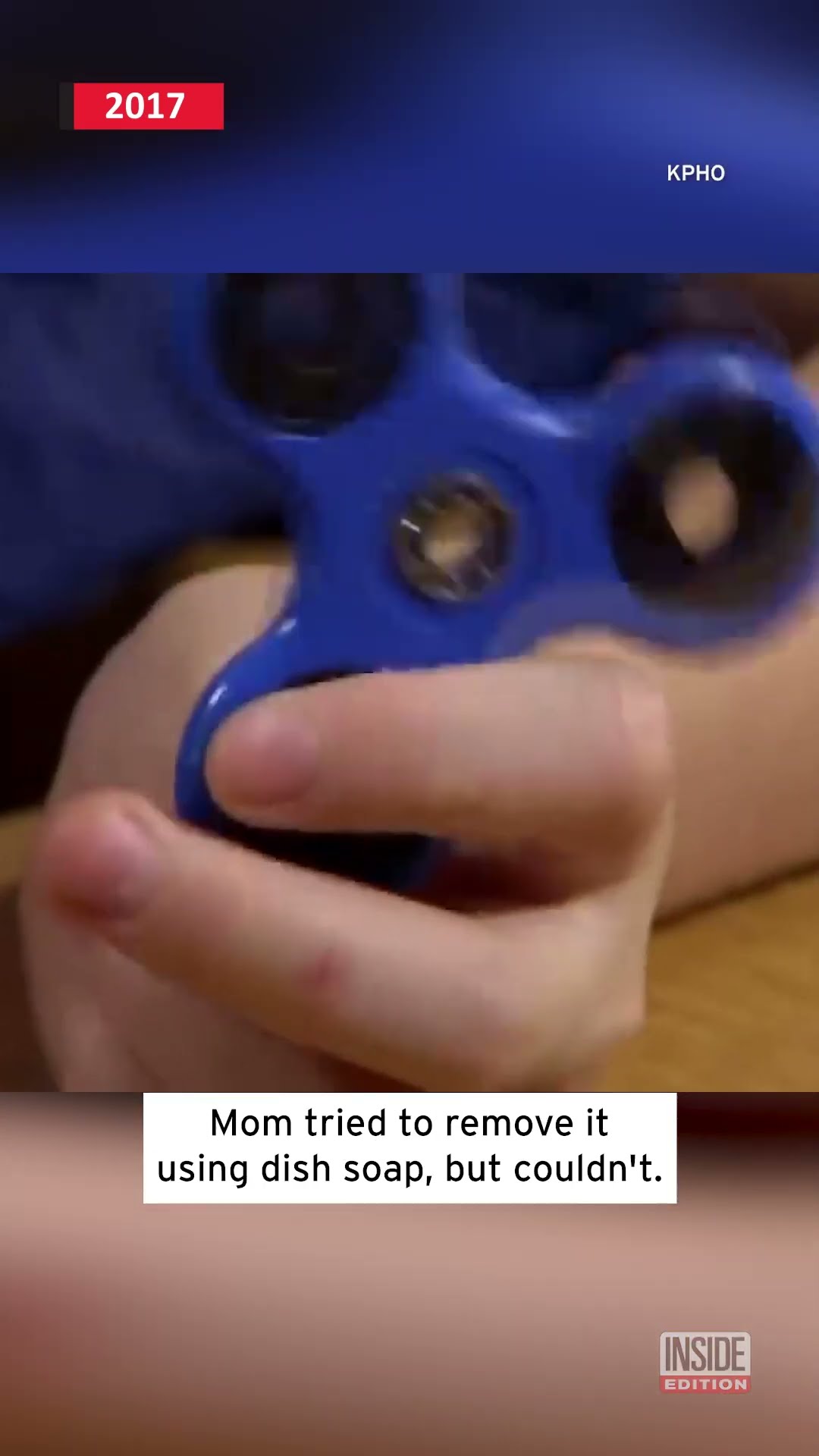 Boy's Finger Was Trapped in Fidget Spinner #shorts – YouTube