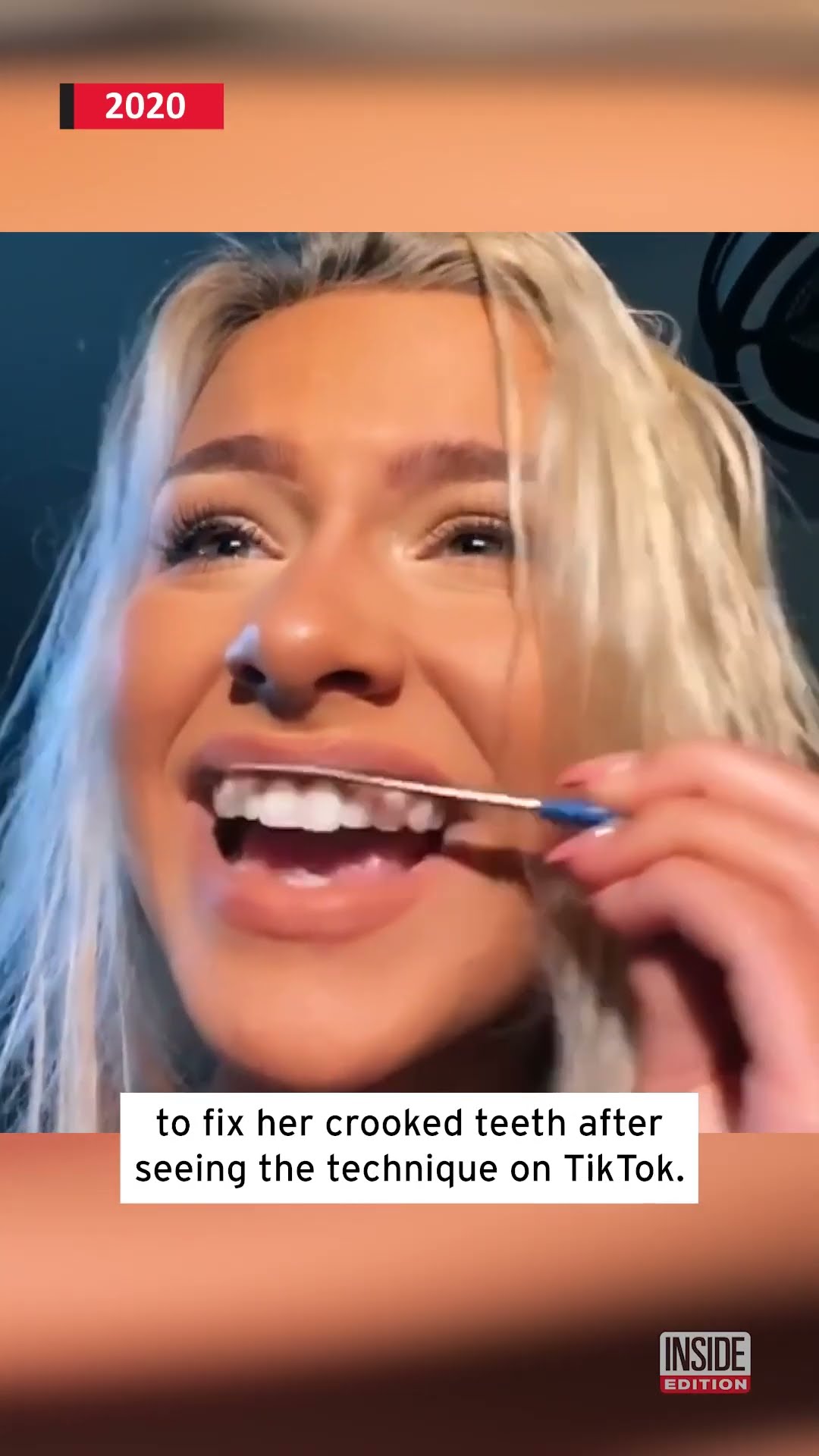 Don't Use a Nail File on Your Teeth #shorts – YouTube