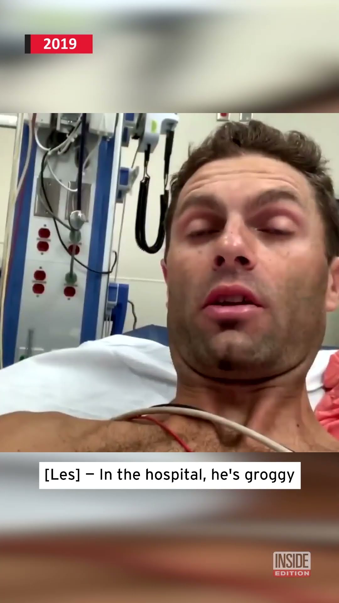 Worker Accidentally Shoots Self With Nail Gun #shorts – YouTube