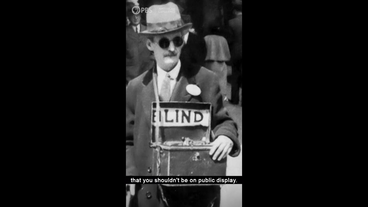 What were "ugly laws"? #Shorts #History #Documentary #Disability – YouTube