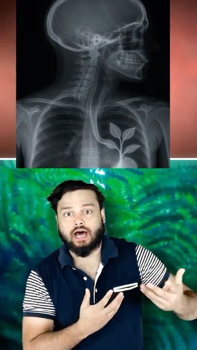 Plant INSIDE Lungs! Very RARE Medical CASE #shorts – YouTube