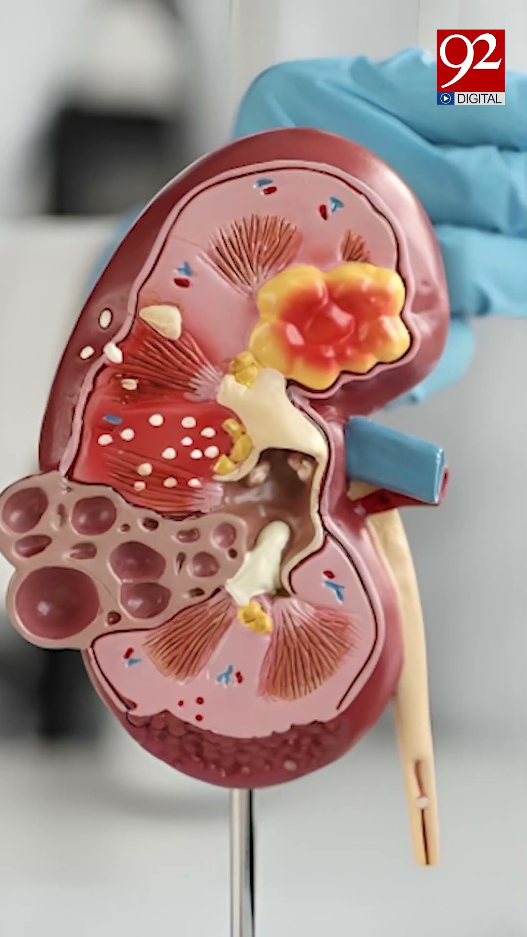 Is it safe to self-treat high blood pressure? #shorts #reels #highbp #selftreatment – YouTube