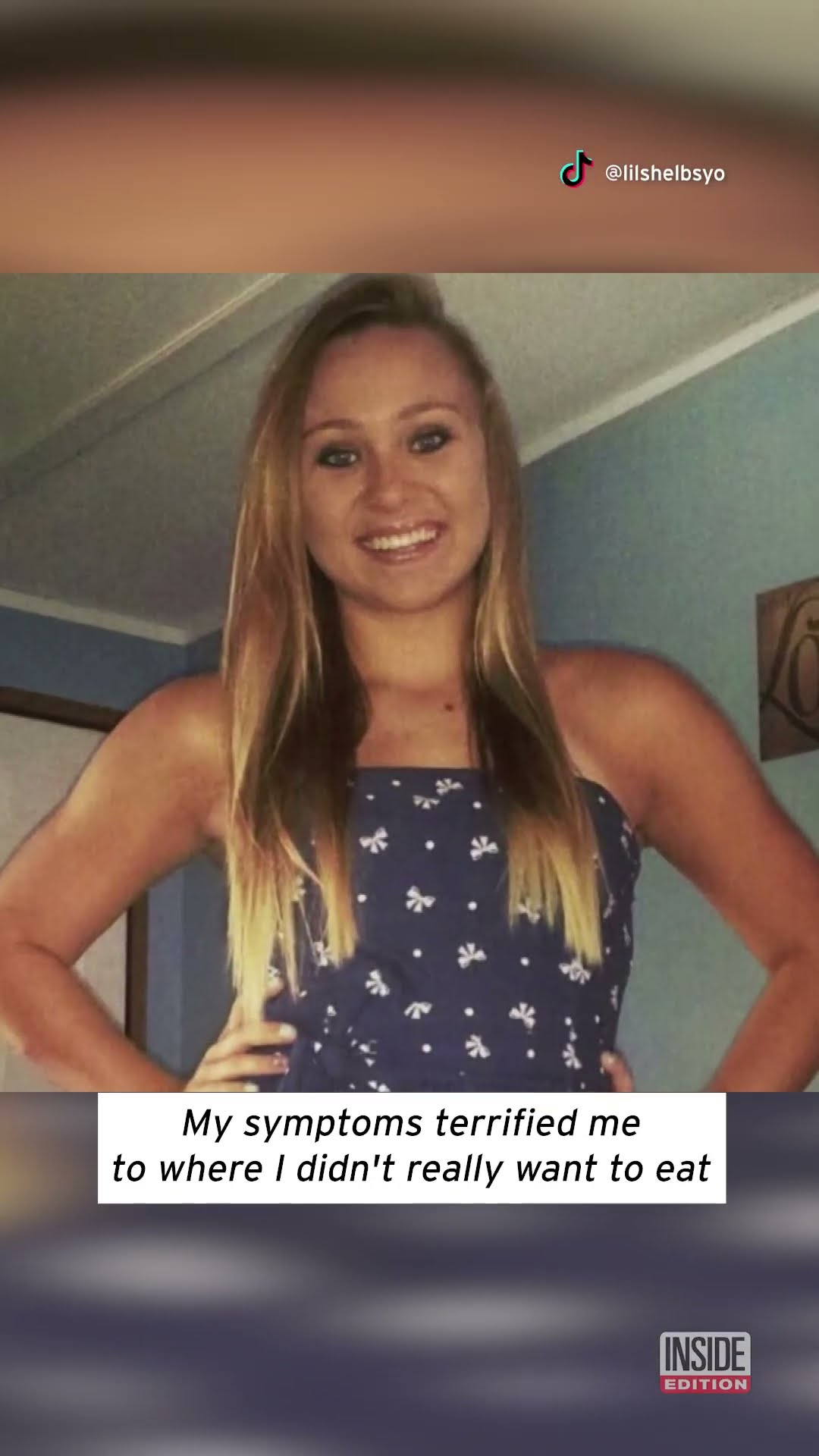 Woman Has Disease That Makes Eating Almost Impossible #shorts – YouTube