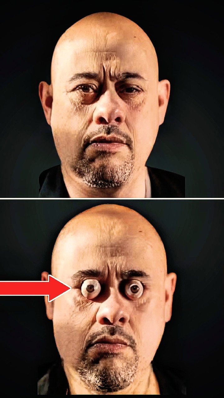 This man takes out his eyes up to 19mm! 😳😱 #Shorts – YouTube