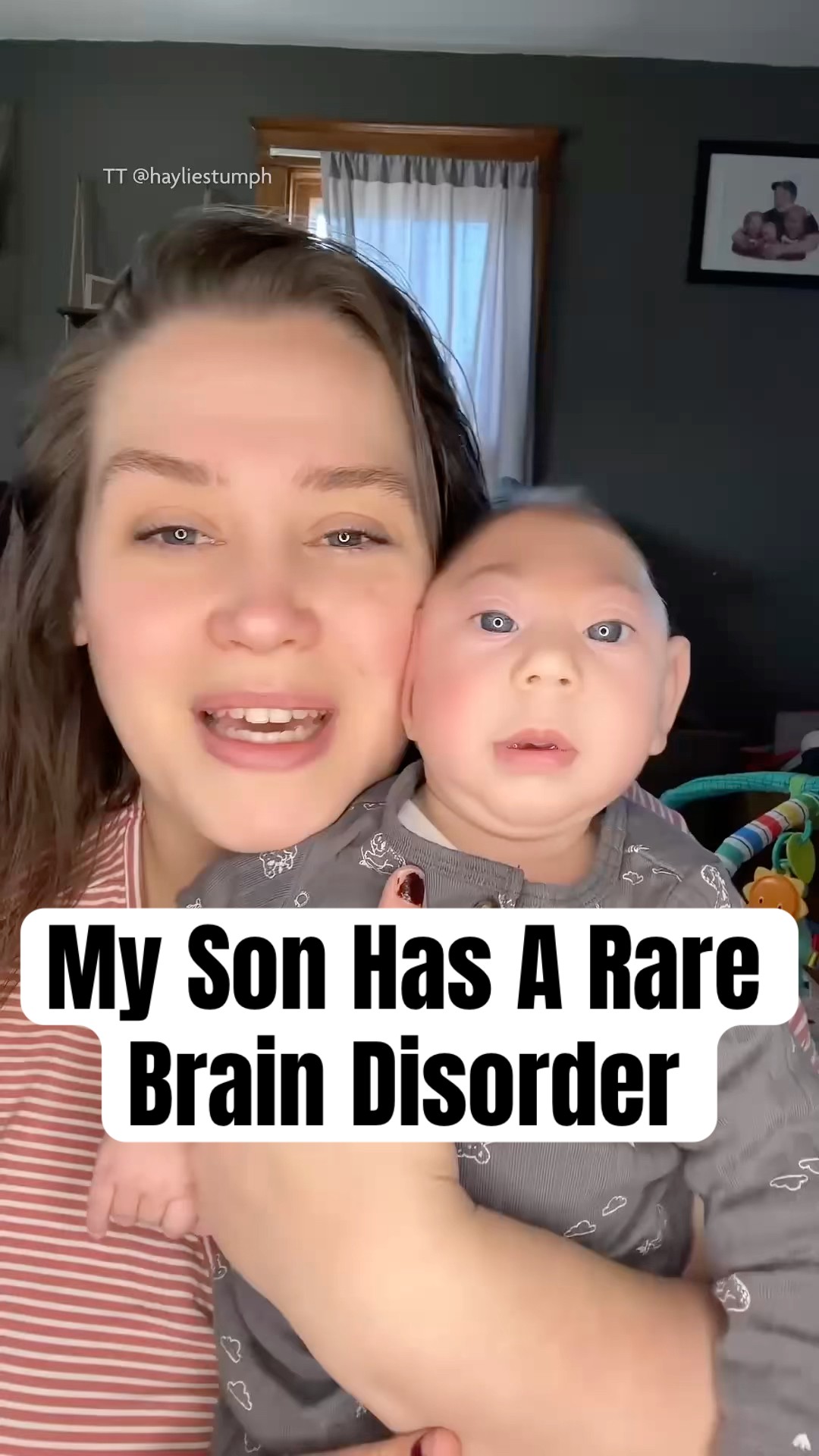 My Son Has A Rare Brain Disorder #shorts #braindisorders #parenting – YouTube