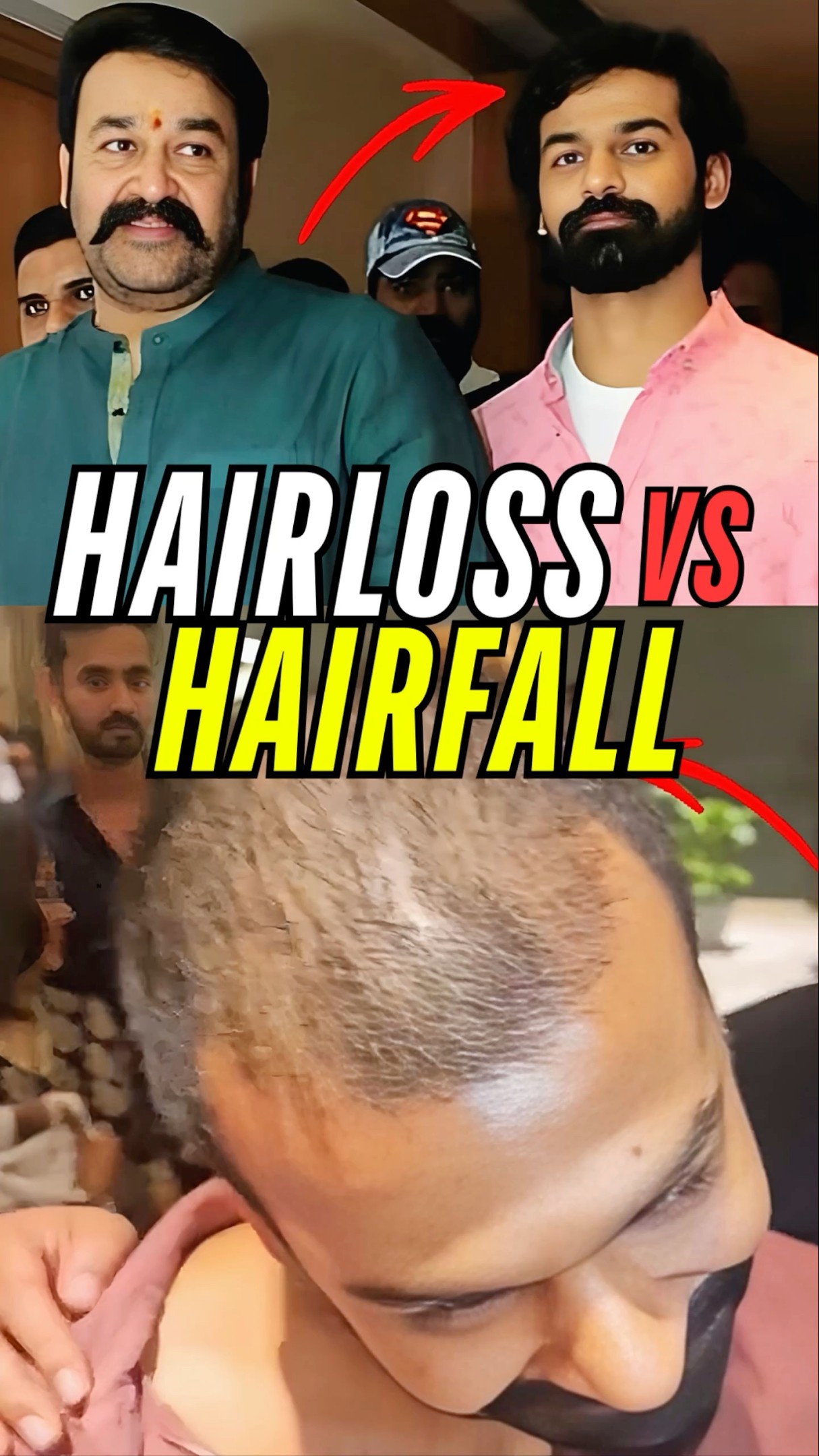 😭How Much Hair Shed Is Normal Per Day🤯 #Shorts #Trending #Short #Beautytips #Malayalam #AswinC – YouTube
